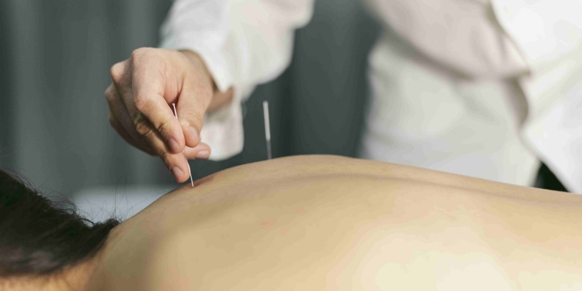 Acupuncture for Hormonal Balance | Restore Wellness Naturally