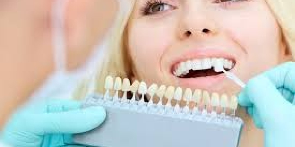 Say Goodbye to Gaps: Discover Life-Changing Dental Implants in Lake Mary