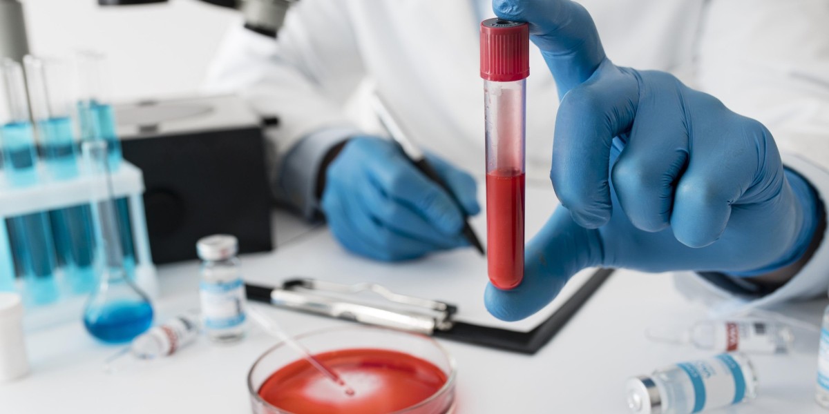 Convenient and Reliable Blood Test at Home in Bangalore – Book Now