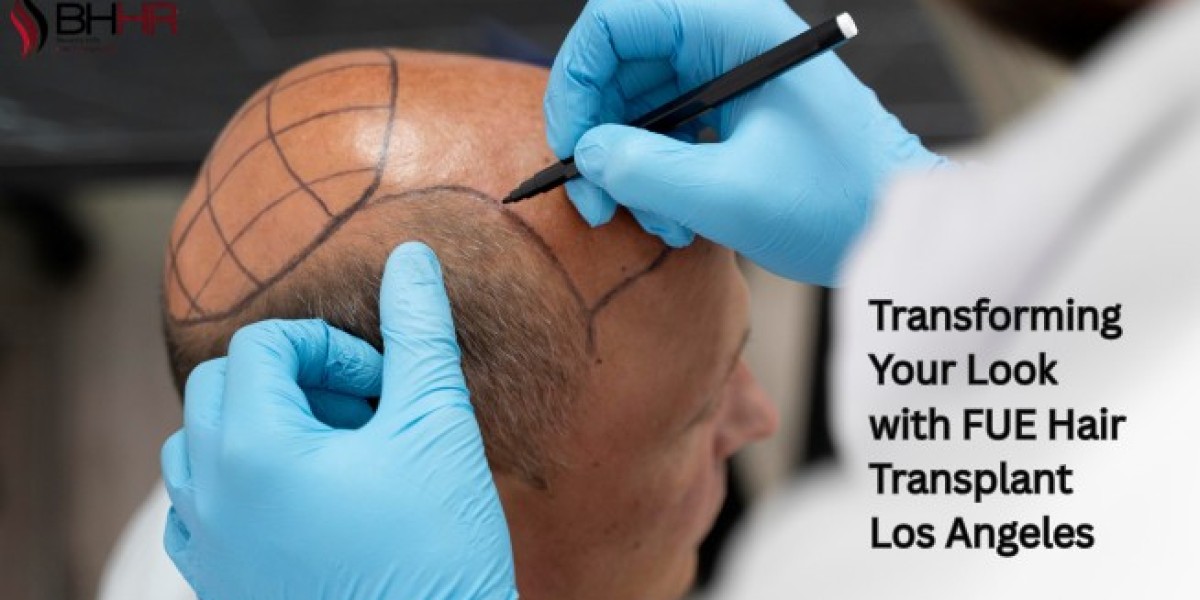 Transforming Your Look with FUE Hair Transplant Los Angeles